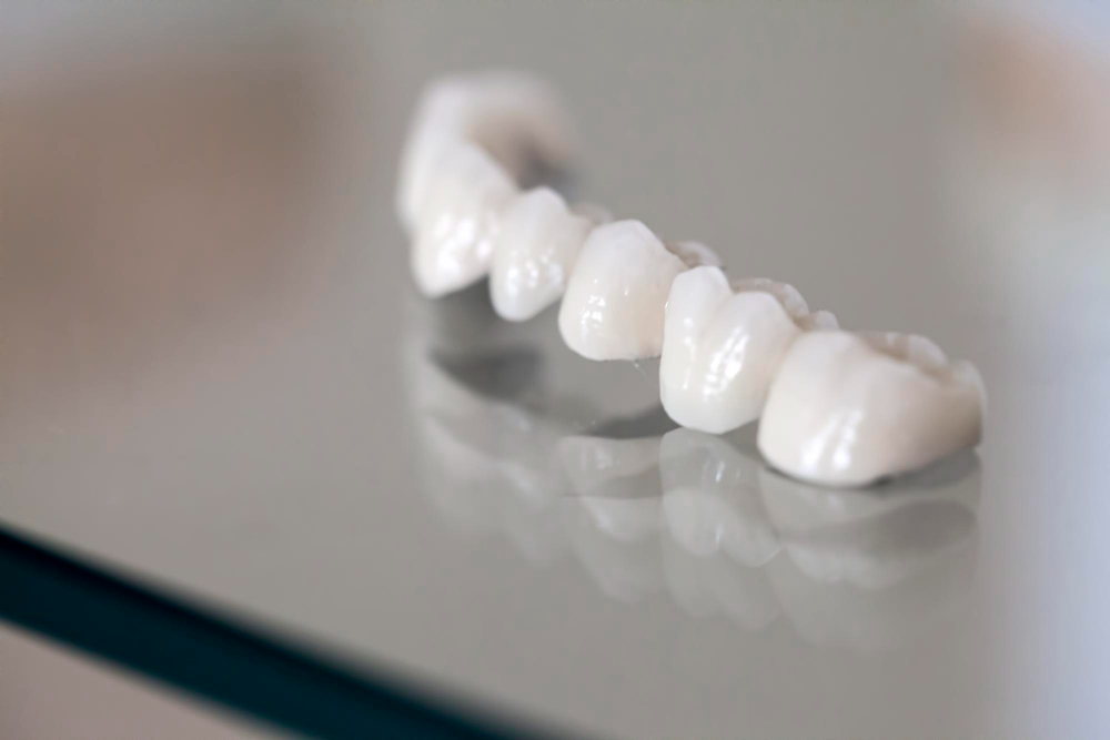 Porcelain Crowns in Artesia